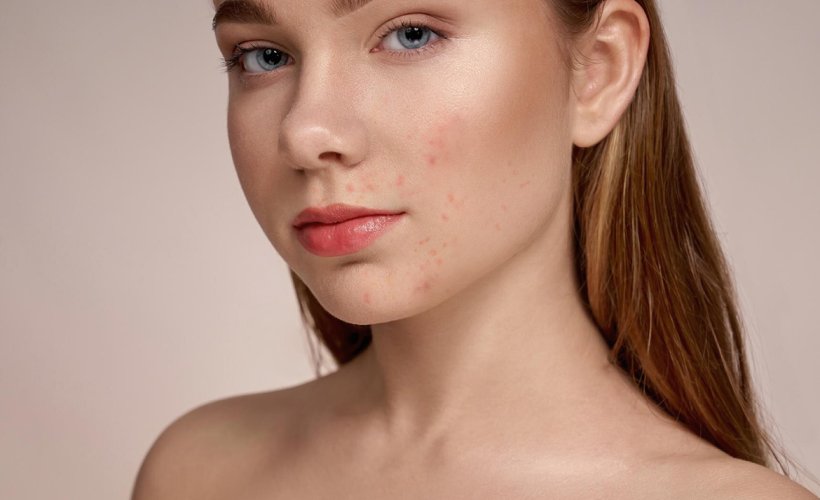 صيدليات السعيد 51 c2 sld bf